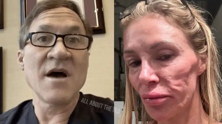 Dr. Terry Dubrow Says Brandi Glanville’s Disfigured Face is a ‘Ticking Time Bomb’