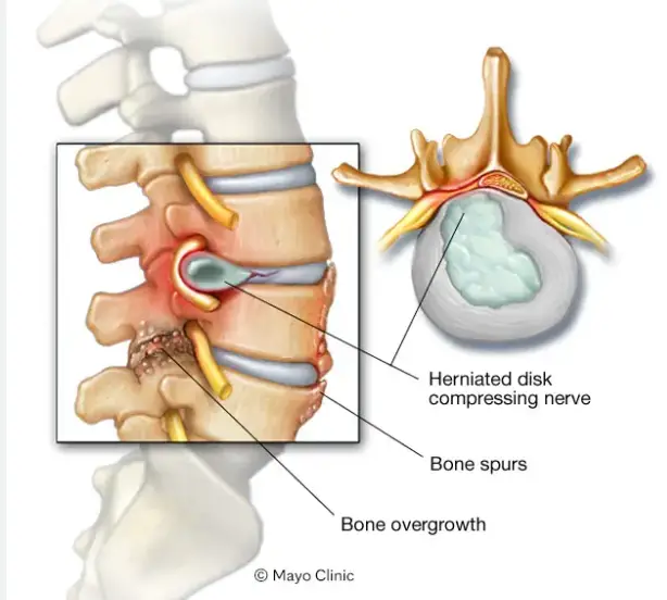 Surprising News From Ortho Doc – BionicOldGuy